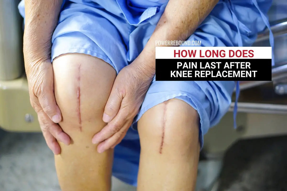 how-long-does-pain-last-after-knee-replacement-what-to-expect